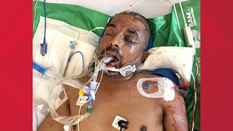 University Hospital asks for help identifying unconscious patient hit by truck Saturday evening — KENS 5 (San Antonio), Farmington Health news